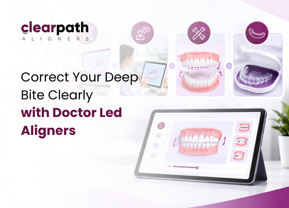 Deep Bite Treatment with Clear Aligners