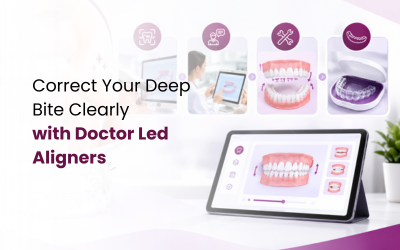 Deep Bite Treatment with Clear Aligners